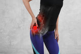 Women's Sciatic Hip Brace for Sciatica Nerve & SI Pain Relief