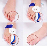 Bunion Corrector Splint Big Toe Straightener Hammer Pain Relief Treatment - StabilityPro™